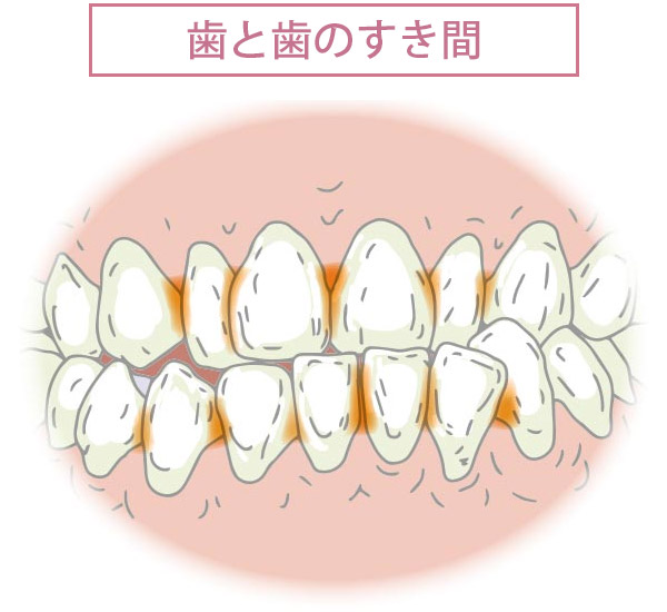 歯と歯のすき間